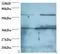 DExD-Box Helicase 39B antibody, LS-B13792, Lifespan Biosciences, Western Blot image 