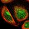 TBC1 Domain Family Member 22A antibody, NBP1-86811, Novus Biologicals, Immunofluorescence image 