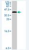 Citron Rho-interacting kinase antibody, H00011113-A01, Novus Biologicals, Western Blot image 