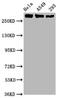 RNA Polymerase II Subunit A antibody, CSB-RA018327A02phHU, Cusabio, Western Blot image 