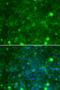 TIMP Metallopeptidase Inhibitor 3 antibody, LS-C331503, Lifespan Biosciences, Immunofluorescence image 