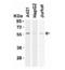 Receptor Interacting Serine/Threonine Kinase 3 antibody, MBS150424, MyBioSource, Western Blot image 