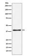 Glutamic-Oxaloacetic Transaminase 1 antibody, M04085, Boster Biological Technology, Western Blot image 