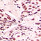 LIM Homeobox Transcription Factor 1 Beta antibody, LS-C352465, Lifespan Biosciences, Immunohistochemistry paraffin image 