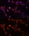 Proteasome 26S Subunit, Non-ATPase 14 antibody, GTX64996, GeneTex, Immunofluorescence image 