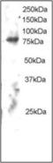 Engulfment And Cell Motility 2 antibody, orb93977, Biorbyt, Western Blot image 