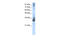 TRNA Methyltransferase 10A antibody, 29-506, ProSci, Western Blot image 