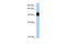 Ring Finger Protein 10 antibody, 29-016, ProSci, Western Blot image 