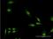 Early Endosome Antigen 1 antibody, H00008411-M03, Novus Biologicals, Immunofluorescence image 