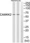 Calcium/Calmodulin Dependent Protein Kinase Kinase 2 antibody, abx015173, Abbexa, Western Blot image 
