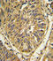 FGFR-2 antibody, LS-C97522, Lifespan Biosciences, Immunohistochemistry paraffin image 