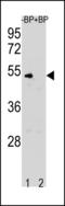 Cycb antibody, LS-C203885, Lifespan Biosciences, Western Blot image 