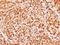 MID1 Interacting Protein 1 antibody, GTX106864, GeneTex, Immunohistochemistry paraffin image 