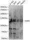 Alanyl-TRNA Synthetase antibody, 14-170, ProSci, Western Blot image 