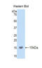 Lysyl Oxidase Like 2 antibody, LS-C295241, Lifespan Biosciences, Western Blot image 