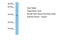 Scd2 antibody, ARP90756_P050, Aviva Systems Biology, Western Blot image 