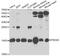 Peroxiredoxin 5 antibody, STJ28251, St John