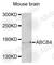 ATP Binding Cassette Subfamily B Member 4 antibody, A9835, ABclonal Technology, Western Blot image 