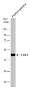 Leucine Rich Alpha-2-Glycoprotein 1 antibody, GTX107355, GeneTex, Western Blot image 