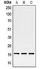 Serine And Arginine Rich Splicing Factor 3 antibody, LS-B13594, Lifespan Biosciences, Western Blot image 