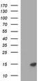 Microseminoprotein Beta antibody, TA803506BM, Origene, Western Blot image 