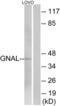 G Protein Subunit Alpha L antibody, LS-C120030, Lifespan Biosciences, Western Blot image 