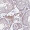Zinc Finger And SCAN Domain Containing 9 antibody, NBP2-31803, Novus Biologicals, Immunohistochemistry paraffin image 
