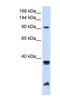 Ring Finger Protein 20 antibody, NBP1-52945, Novus Biologicals, Western Blot image 
