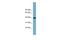 SAM And SH3 Domain Containing 3 antibody, PA5-70305, Invitrogen Antibodies, Western Blot image 