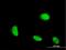 Cysteine And Glycine Rich Protein 1 antibody, H00001465-M06, Novus Biologicals, Immunocytochemistry image 