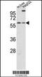 Cryptochrome Circadian Regulator 2 antibody, 62-137, ProSci, Western Blot image 