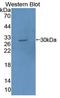 Troponin I3, Cardiac Type antibody, LS-C297758, Lifespan Biosciences, Western Blot image 