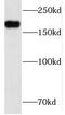 Inverted Formin, FH2 And WH2 Domain Containing antibody, FNab04307, FineTest, Western Blot image 