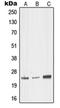 Mediator Complex Subunit 18 antibody, orb215202, Biorbyt, Western Blot image 