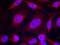 ATP Binding Cassette Subfamily B Member 5 antibody, orb15028, Biorbyt, Immunocytochemistry image 