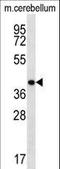 Homeobox D13 antibody, LS-C164417, Lifespan Biosciences, Western Blot image 