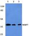 Lysine Methyltransferase 2B antibody, A05680, Boster Biological Technology, Western Blot image 