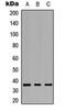 G Protein-Coupled Bile Acid Receptor 1 antibody, MBS8211521, MyBioSource, Western Blot image 