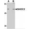 SHOC2 Leucine Rich Repeat Scaffold Protein antibody, MBS150121, MyBioSource, Western Blot image 