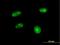Aprataxin antibody, H00054840-B01P, Novus Biologicals, Immunocytochemistry image 