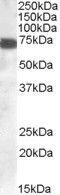 Zinc Finger DHHC-Type Containing 13 antibody, GTX89603, GeneTex, Western Blot image 