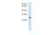 Gamma-Glutamyltransferase Light Chain 1 antibody, PA5-69148, Invitrogen Antibodies, Western Blot image 