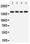 Tenascin R antibody, PA1695-1, Boster Biological Technology, Western Blot image 