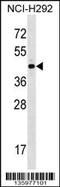 Zinc Finger Protein 436 antibody, 58-535, ProSci, Western Blot image 