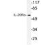 Interleukin 20 Receptor Subunit Alpha antibody, LS-C177536, Lifespan Biosciences, Western Blot image 