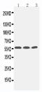 Potassium voltage-gated channel subfamily C member 1 antibody, PA2298, Boster Biological Technology, Western Blot image 