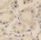 NUAK family SNF1-like kinase 2 antibody, FNab05886, FineTest, Immunohistochemistry paraffin image 