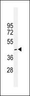 Corticotropin Releasing Hormone Receptor 1 antibody, LS-C167034, Lifespan Biosciences, Western Blot image 