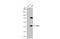 Pro-Apoptotic WT1 Regulator antibody, GTX133766, GeneTex, Western Blot image 