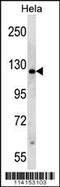 Poly(ADP-Ribose) Polymerase 1 antibody, 62-267, ProSci, Western Blot image 